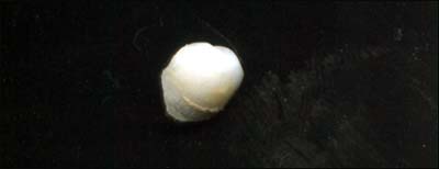 Nothing but the tooth